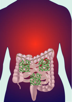 intestines-with-gut-bacteria
